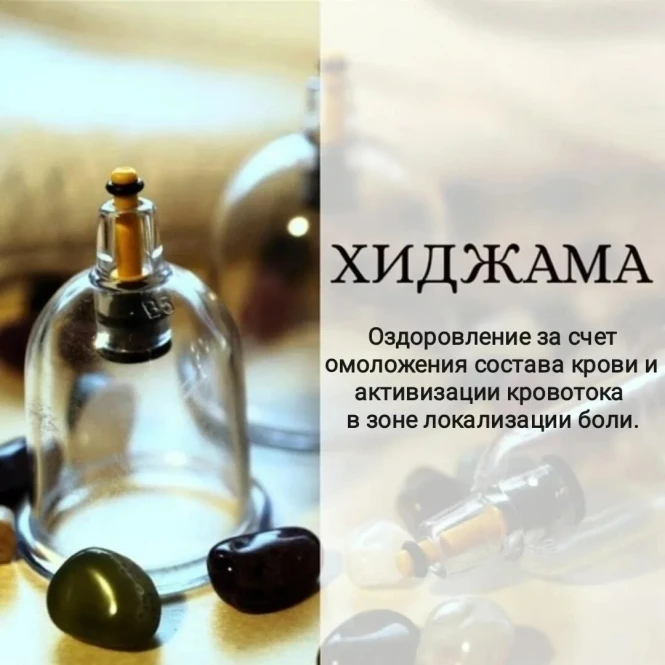 Хиджама при хроническом стрессе — от 10000 тг, 60 минут - 2690 - фото 1